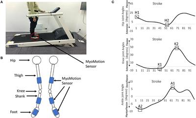 The Effect of Inclines on Joint Angles in Stroke Survivors During Treadmill Walking